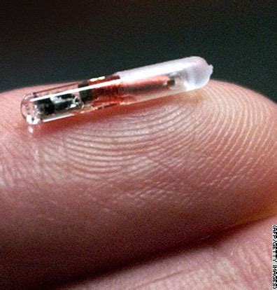 rfid-chip implantat mensch|Microchip implant (human) .